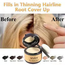 Sevich Hairline Powder 4g Hairline Shadow Powder Makeup Hair Concealer Natural Cover Unisex Hair Loss Product