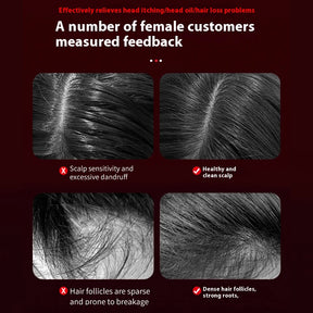 Electric Massage Comb 3 Modes Portable Red Light Laser Comb for Hair Follicle Hair Follicles On The Head Essence Oil Applicator