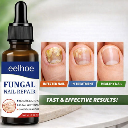 Nail Care Antifungal Solution – Sundere negle Start her